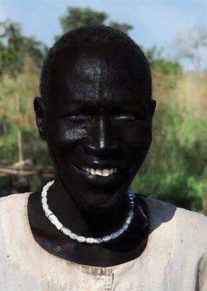 Blackest Person In World