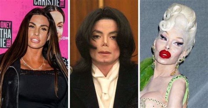 Chris Rock Fans Assumed That He Have Done Plastic Surgery