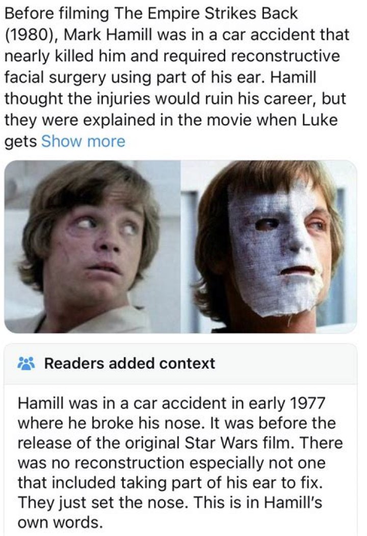Crash: Mark Hamill Car Accident Injury Fractured Nose And Left Cheekbone