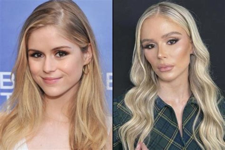 Mikhaila Peterson's Plastic Surgery Journey Revealed
