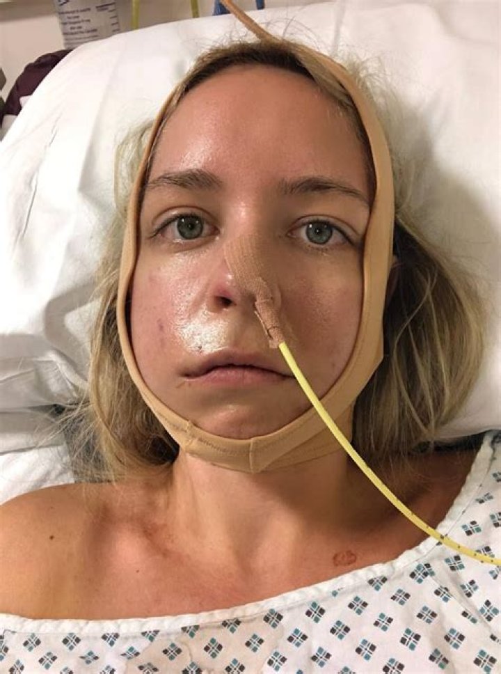 Mimi Before Surgery: A Personal Journey