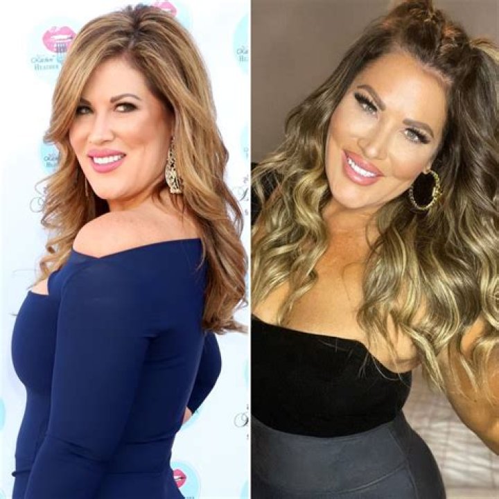 RHOC: Nicole Weiss Before Surgery How Did She Look? Young Photos