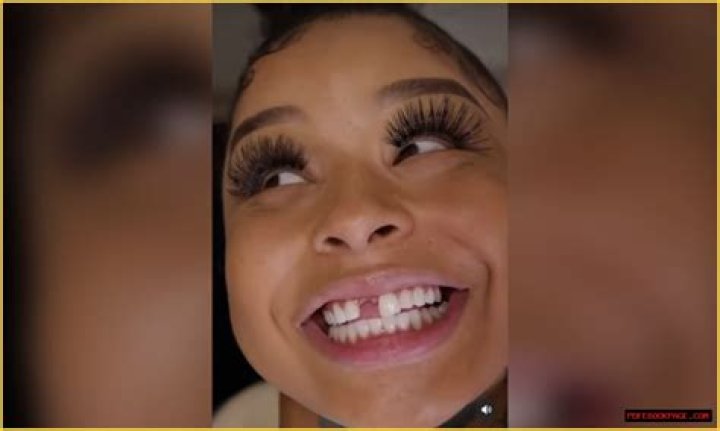 The Truth Behind Chrisean Rock's Lost Tooth