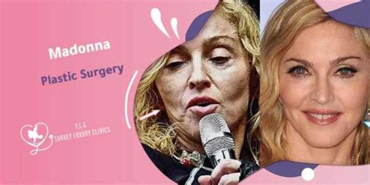 Uncovering The Plastic Surgery Rumors
