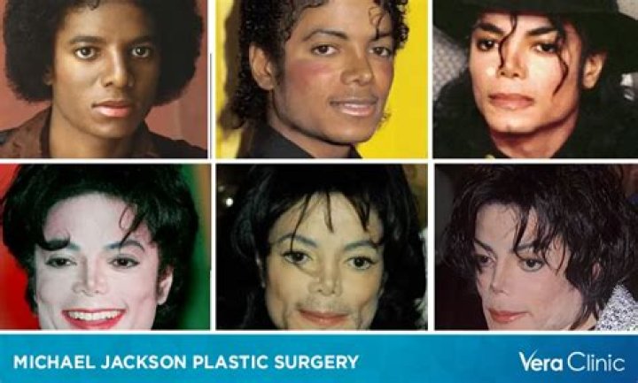 Unveiling Cindy Jackson's Plastic Surgery Journey: Insights And Revelations