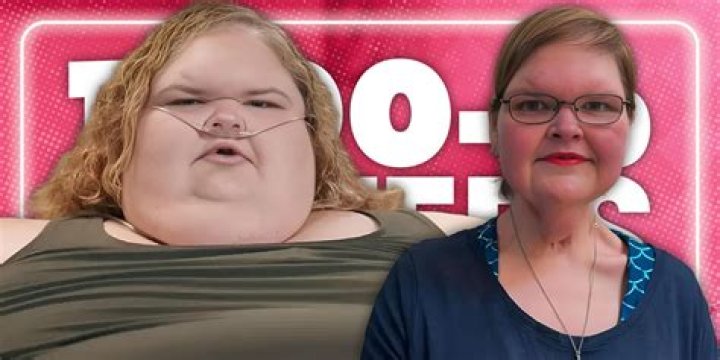 Unveiling The Enigma Of "Tammy Forehead": Discoveries And Insights