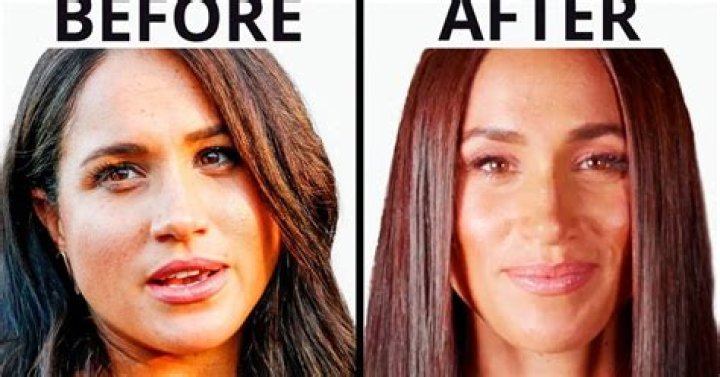Unveiling The Truth Behind The Plastic Surgery Rumors